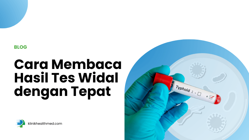hasil tes widal, cara membaca hasil test widal
