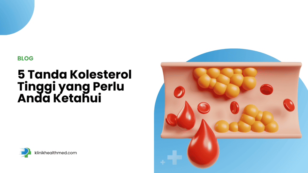 tanda kolesterol tinggi