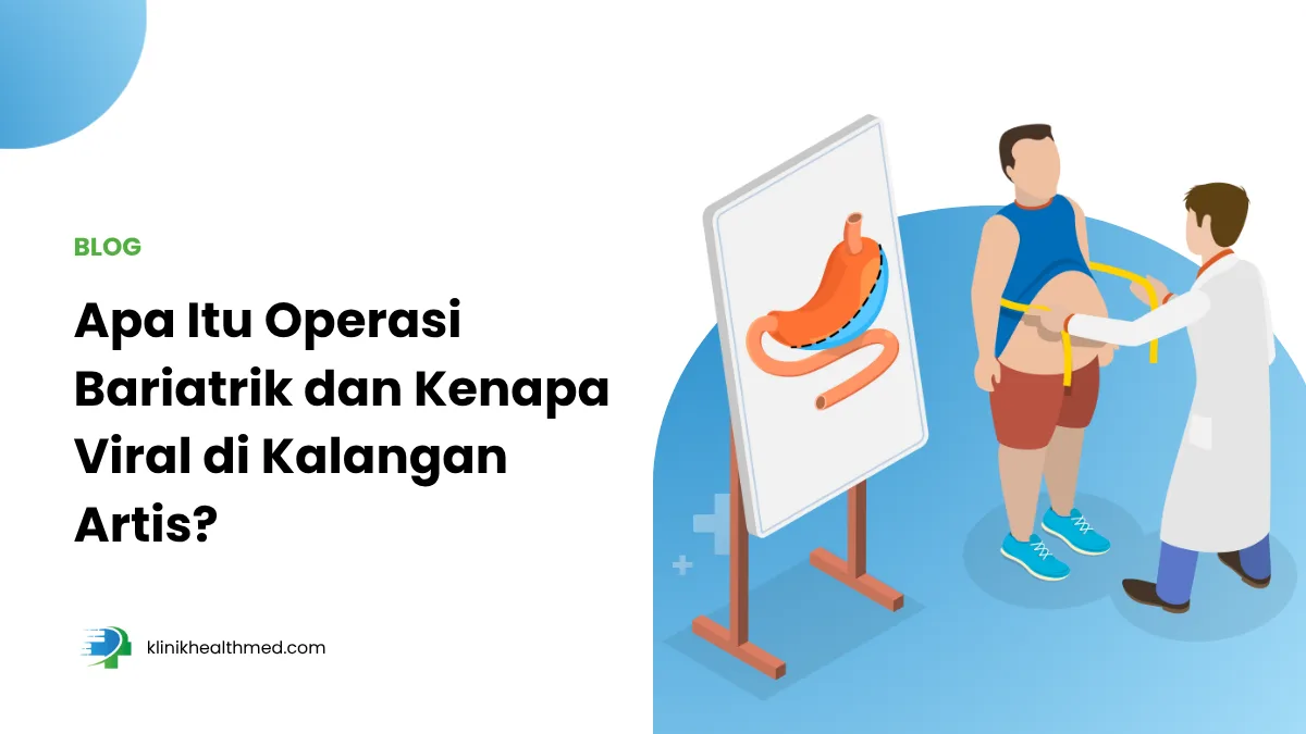 apa itu operasi bariatrik, viral operasi bariatrik