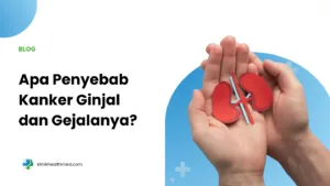 Penyebab kanker ginjal, vidi aldiano sakit apa, vidi sakit kanker ginjal, cara mencegah kanker ginjal, gejala kanker ginjal