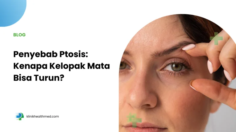 Penyebab ptosis, kenapa kelopak mata turun, ptosis pada anak, ptosis pada orang dewasa