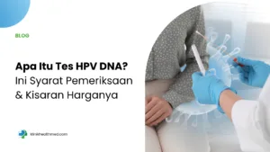 Apa itu tes HPV DNA, harga tes hpv dna, berapa harga tes HPV DNA, siapa yang perlu tes HPV DNA