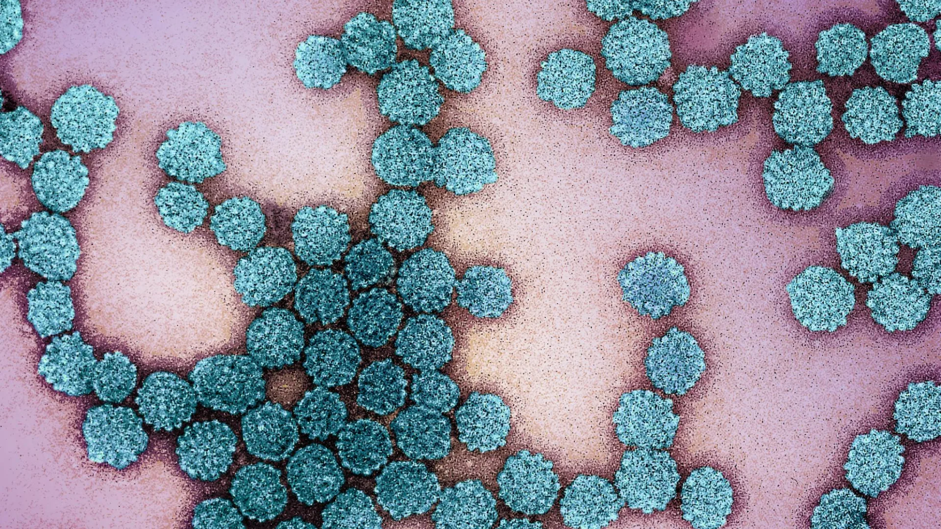 Seputar Virus HPV