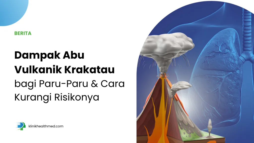 Dampak Abu Vulkanik Krakatau bagi Paru-Paru dan Cara Kurangi Risikonya