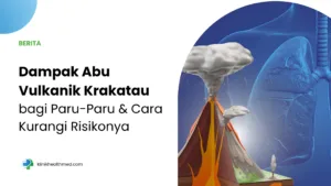 Dampak Abu Vulkanik Krakatau bagi Paru-Paru dan Cara Kurangi Risikonya
