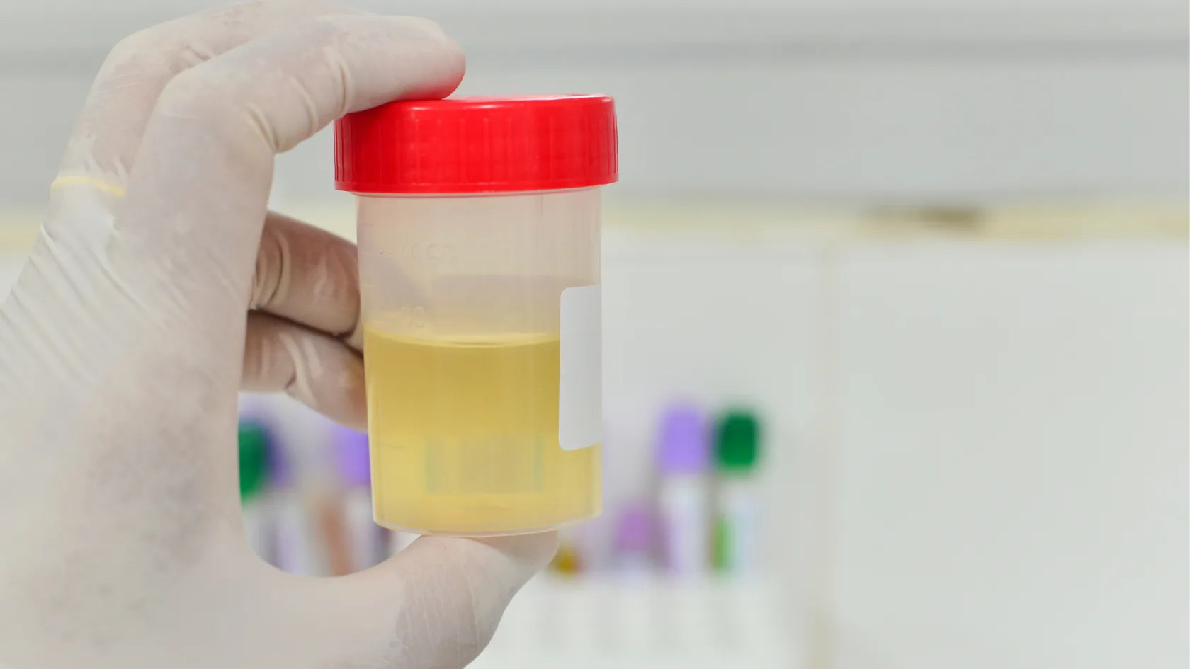 Tes Urine untuk Narkoba
